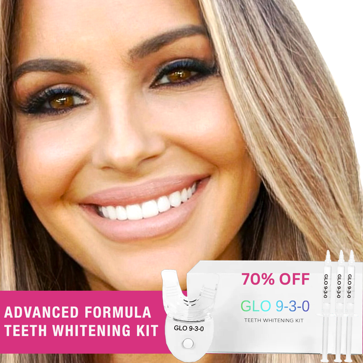 GLO 9-3-0 Teeth Whitening Kit